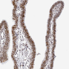 Immunohistochemical staining of human Fallopian tube shows moderate nuclear positivity in glandular cells.