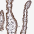 Immunohistochemical staining of human Fallopian tube shows moderate nuclear positivity in glandular cells.