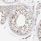 Immunohistochemical staining of human testis shows moderate nuclear positivity in cells in seminiferous ducts.