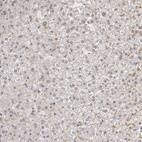 Immunohistochemical staining of human liver shows no positivity in hepatocytes as expected.
