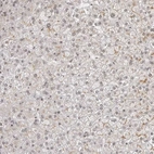 Immunohistochemical staining of human liver shows no positivity in hepatocytes as expected.