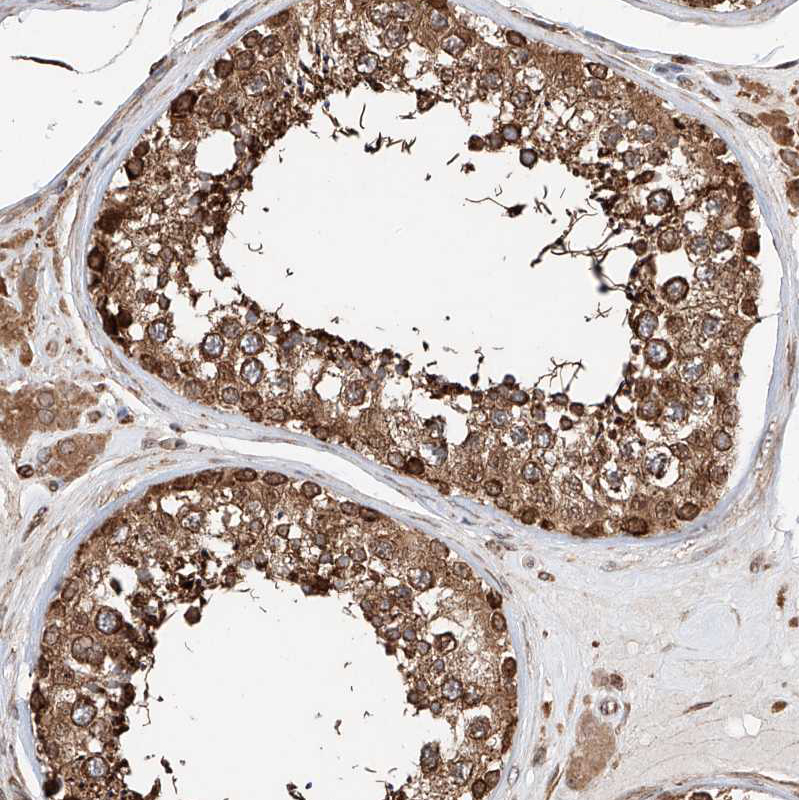 Anti-DNAH8 Antibody