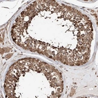 Anti-DNAH8 Antibody