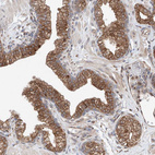 Immunohistochemical staining of human prostate shows strong cytoplasmic positivity in glandular cells.