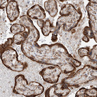 Immunohistochemical staining of human placenta shows strong cytoplasmic positivity in trophoblastic cells.