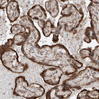 Anti-DNAH8 Antibody