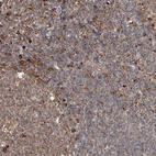 Immunohistochemical staining of human tonsil shows strong cytoplasmic positivity in non-germinal center cells.