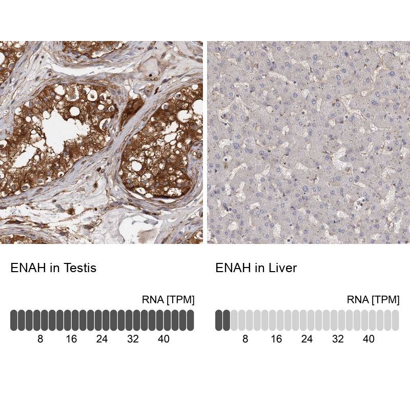 Anti-ENAH Antibody