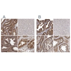 Immunohistochemical staining of human fallopian tube, liver, prostate and testis using Anti-ENAH antibody HPA028448 (A) shows similar protein distribution across tissues to independent antibody HPA028696 (B).