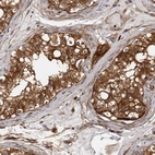 Immunohistochemical staining of human testis shows strong cytoplasmic positivity in cells in seminiferous ducts.