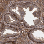 Immunohistochemical staining of human prostate shows moderate to strong cytoplasmic and membranous positivity in glandular cells and smooth muscle cells.