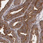 Immunohistochemical staining of human Fallopian tube shows strong cytoplasmic and membranous positivity in glandular cells.