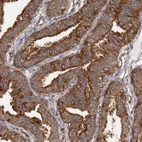 Immunohistochemical staining of human Fallopian tube shows strong cytoplasmic and membranous positivity in glandular cells.