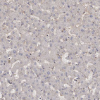 Immunohistochemical staining of human liver shows low positivity in hepatocytes as expected.