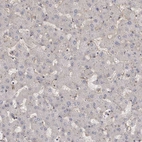 Immunohistochemical staining of human liver shows low positivity in hepatocytes as expected.