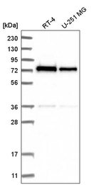 Anti-ZNF326 Antibody