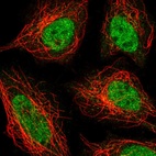 Immunofluorescent staining of human cell line SiHa shows localization to nucleoplasm.