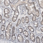 Anti-C1orf131 Antibody