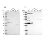 Western blot analysis using Anti-C1orf131 antibody HPA028452 (A) shows similar pattern to independent antibody HPA029920 (B).