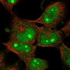 Immunofluorescent staining of human cell line U-251 MG shows localization to nucleus & nucleoli.
