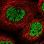 Immunofluorescent staining of human cell line A-431 shows localization to nucleoplasm.