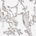 Immunohistochemical staining of human lung shows strong nuclear positivity in pneumocytes.