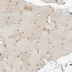 Immunohistochemical staining of human skeletal muscle shows strong nuclear positivity in myocytes.