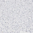 Immunohistochemical staining of human liver shows no positivity in hepatocytes as expected.