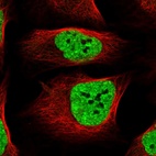 Immunofluorescent staining of human cell line U-2 OS shows localization to nucleoplasm.