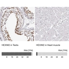 Anti-HEXIM2 Antibody