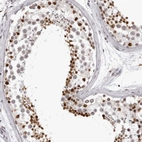 Immunohistochemical staining of human testis shows high expression.