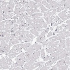 Immunohistochemical staining of human heart muscle shows low expression as expected.