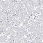 Immunohistochemical staining of human heart muscle shows low expression as expected.