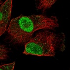 Immunofluorescent staining of human cell line U-251 MG shows localization to nucleoplasm.