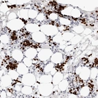 Anti-EDN2 Antibody