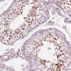 Immunohistochemical staining of human testis shows high expression.