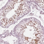 Immunohistochemical staining of human testis shows high expression.