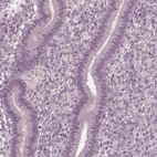 Immunohistochemical staining of human endometrium shows low expression as expected.