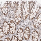 Anti-ITGB3BP Antibody