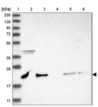 Lane 1: Marker [kDa] 230, 130, 95, 72, 56, 36, 28, 17, 11_br/_Lane 2: Human cell line RT-4_br/_Lane 3: Human cell line U-251MG sp_br/_Lane 4: Human plasma (IgG/HSA depleted)_br/_Lane 5: Human liver tissue_br/_Lane 6: Human tonsil tissue
