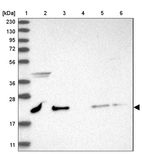 Lane 1: Marker [kDa] 230, 130, 95, 72, 56, 36, 28, 17, 11_br/_Lane 2: Human cell line RT-4_br/_Lane 3: Human cell line U-251MG sp_br/_Lane 4: Human plasma (IgG/HSA depleted)_br/_Lane 5: Human liver tissue_br/_Lane 6: Human tonsil tissue