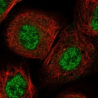 Immunofluorescent staining of human cell line A-431 shows localization to nucleoplasm.