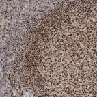 Immunohistochemical staining of human lymph node shows strong nuclear positivity in germinal center cells.