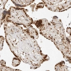 Anti-CRTC2 Antibody