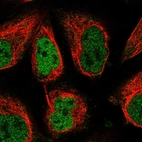 Immunofluorescent staining of human cell line U-2 OS shows localization to nucleoplasm.
