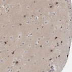 Anti-EXOSC10 Antibody