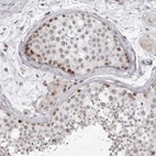 Immunohistochemical staining of human Testis shows moderate nuclear positivity in cells in seminiferous ducts and leydig cells.