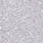 Immunohistochemical staining of human Liver shows very weak nuclear positivity in hepatocytes.