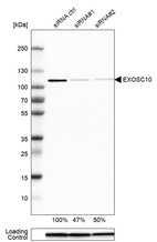 Anti-EXOSC10 Antibody