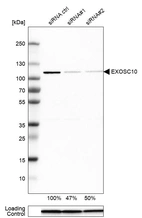 Western blot analysis in HEK293 cells transfected with control siRNA, target specific siRNA probe #1 and #2, using Anti-EXOSC10 antibody. Remaining relative intensity is presented. Loading control: Anti-GAPDH.